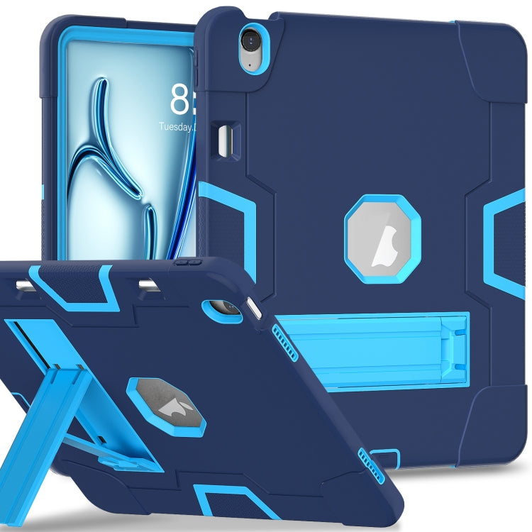 EDA006650302C.jpg@5b96ba807004e7ee735352f40abff10c